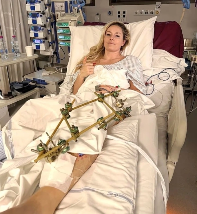 Lindsey Vonn after the surgery. Photo by Instagram/@lindseyvonn