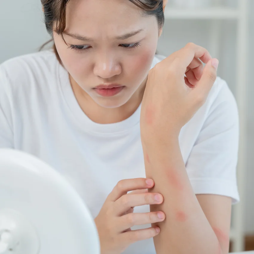 woman breaking out into hives at the thought of going to work