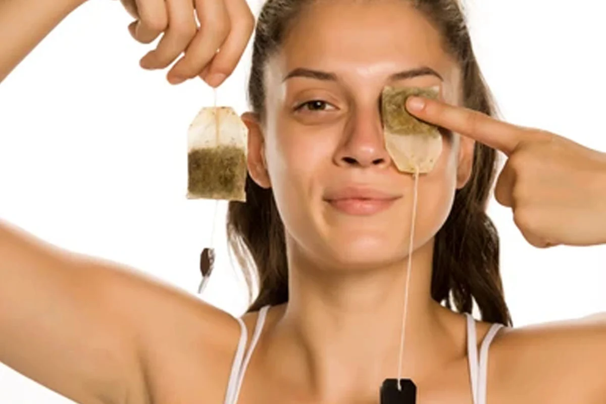 Try 5 simple home remedies to reduce under-eye puffiness and dark circles