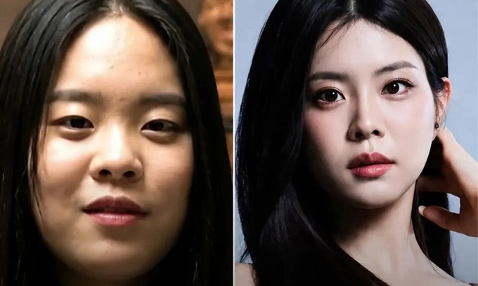 Old and recent photos of Woo Seo Yoon caused discussion on beauty forums. Photo: Instagram/Rocket Mag