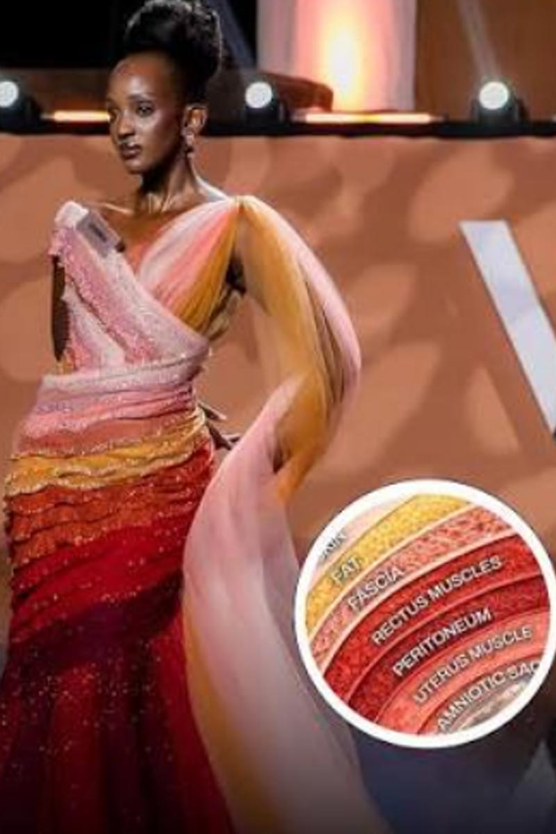 Miss Uganda's 'Layers of Life' Gown Depicts 7 Layers of C-Section