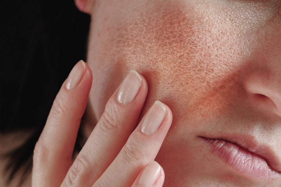 Skincare routine for clear and healthy skin during Puja